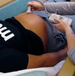 centering pregnancy image centering pregnancy image